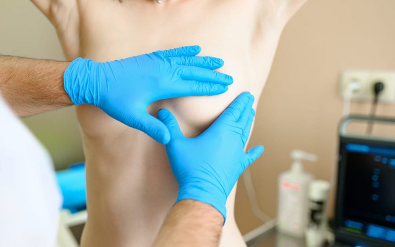 Reafirmación de senos tras la lactancia sin marcas visibles